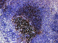 CD23 Monoclonal Antibody Stored at -20°C