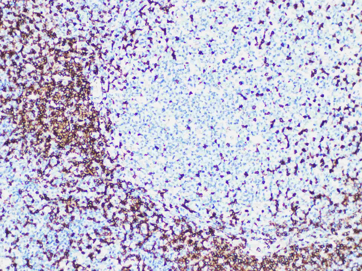 CD3 Monoclonal Antibody Stored at -20°C Host Rabbit