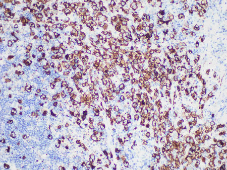 CD30 Monoclonal Antibody Stored at -20°C