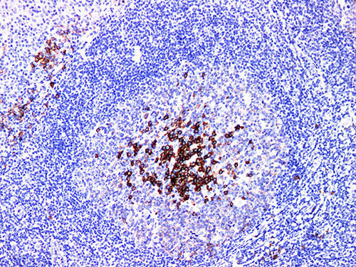 CD38 Monoclonal Antibody Stored at -20°C
