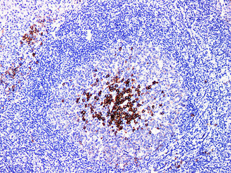 CD38 Monoclonal Antibody Stored at -20°C