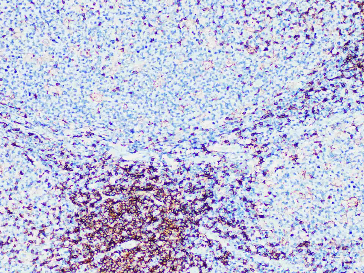 CD4 Monoclonal Antibody Stored at -20°C