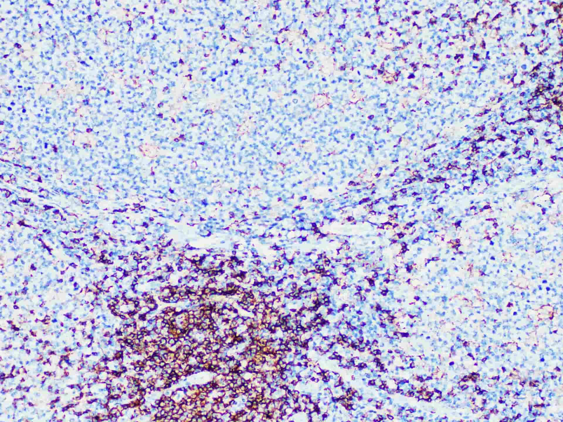 CD4 Monoclonal Antibody Stored at -20°C