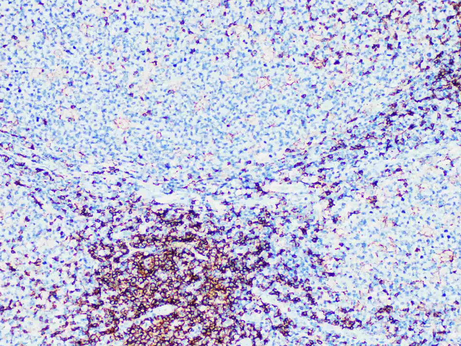 CD4 Monoclonal Antibody Stored at -20°C