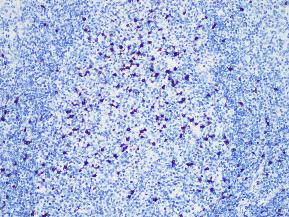 CD57 Monoclonal Antibody