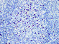 CD57 Monoclonal Antibody