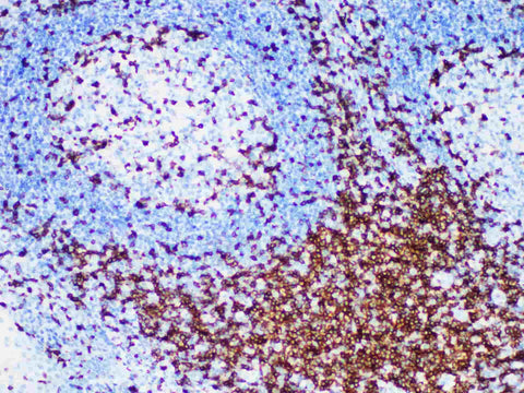 CD7 Monoclonal Antibody Stored at -20°C