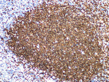 CD79a Monoclonal Antibody Stored at -20°C Host Rabbit