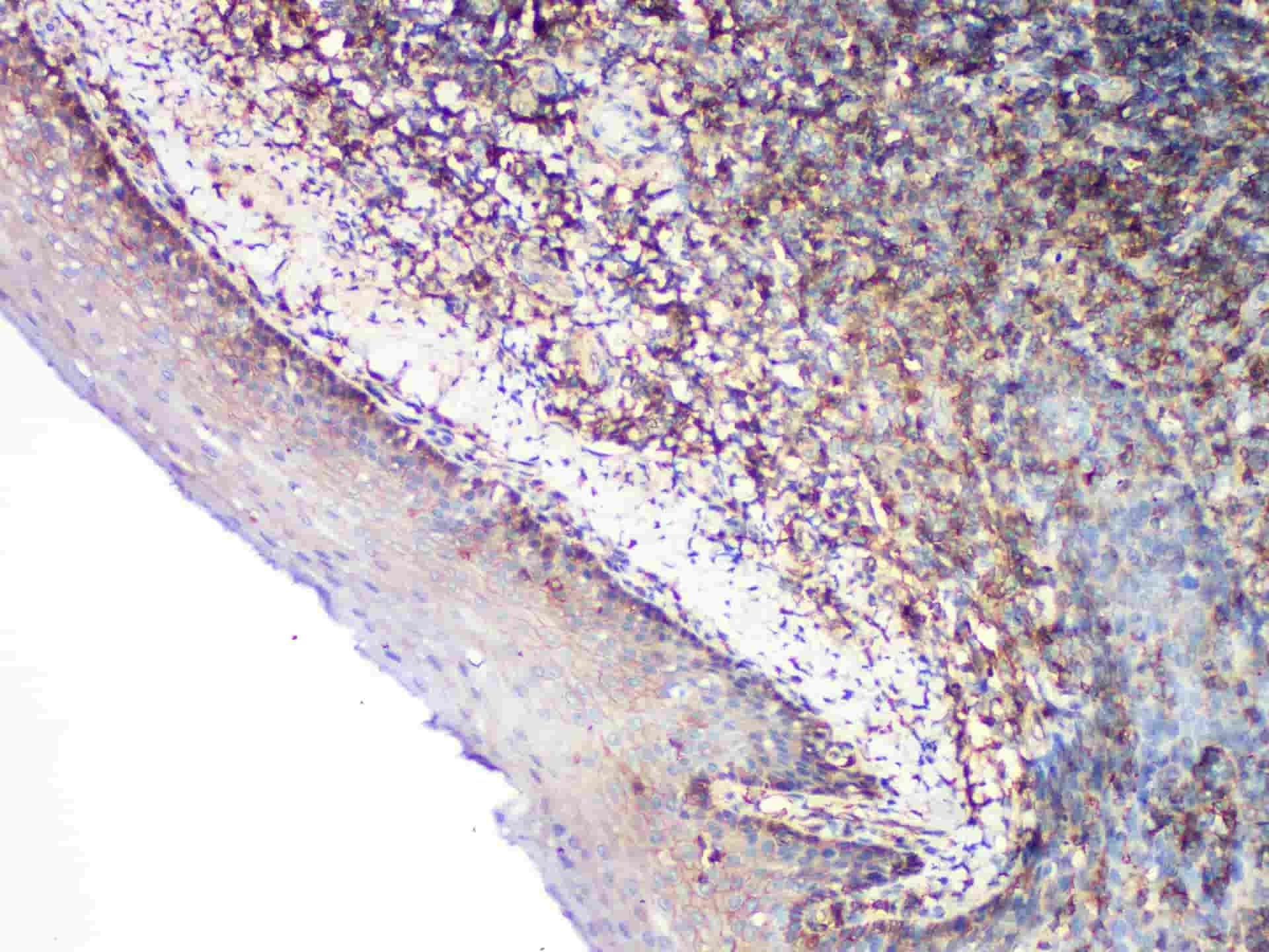 CD99 Monoclonal Antibody Stored at -20°C