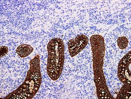 CEA Monoclonal Antibody Stored at -20°C