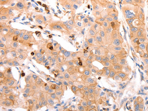 CELSR2 Polyclonal Antibody Store at -20°C