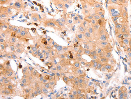 CELSR2 Polyclonal Antibody Store at -20°C