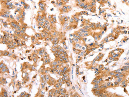 CELSR2 Polyclonal Antibody Store at -20°C