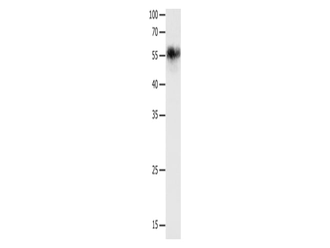 CHRNA3 Polyclonal Antibody Store at -20°C, Biomarkers, Elabscience Biotechnology, MSE Supplies