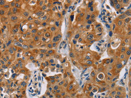 CK-13 Polyclonal Antibody Store at -20°C