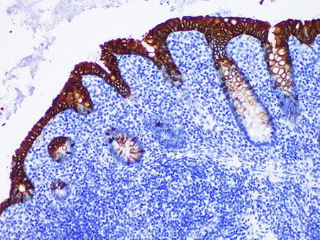 CK20 Monoclonal Antibody Stored at -20°C