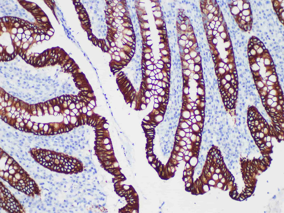 CK20 Monoclonal Antibody Stored at -20°C