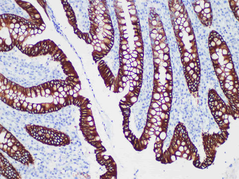CK20 Monoclonal Antibody Stored at -20°C