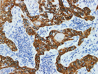 CK5 Monoclonal Antibody Stored at -20°C