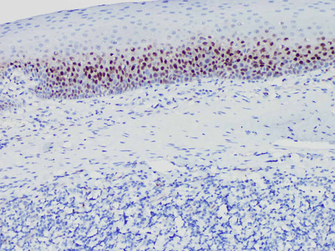 Cyclin D1 Monoclonal Antibody Stored at -20°C