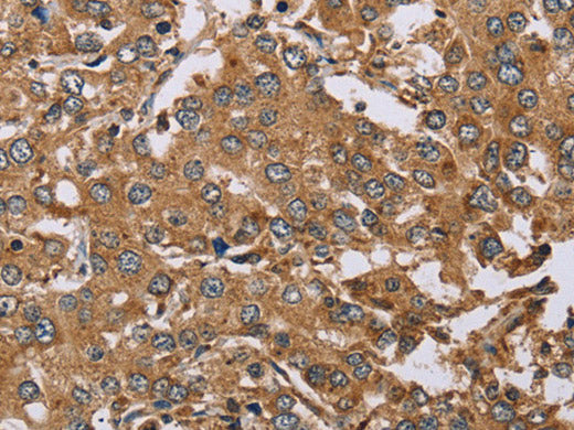 DDAH1 Polyclonal Antibody Store at -20°C