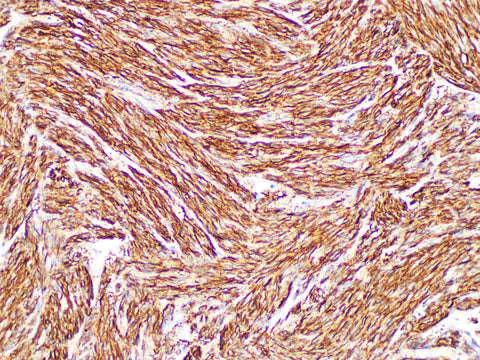 DOG1 Monoclonal Antibody Stored at -20°C