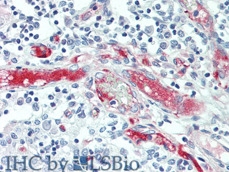 APOL1 Polyclonal Antibody Store at -20°C