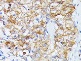 ECE1 Polyclonal Antibody