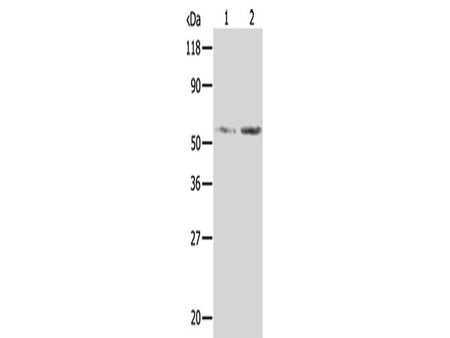 AKR1B1 Polyclonal Antibody Store at -20°C