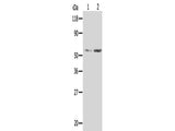 AKR1B1 Polyclonal Antibody Store at -20°C