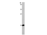 PFN2 Polyclonal Antibody