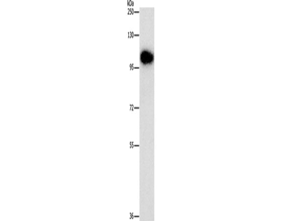 DNM3 Polyclonal Antibody Store at -20°C