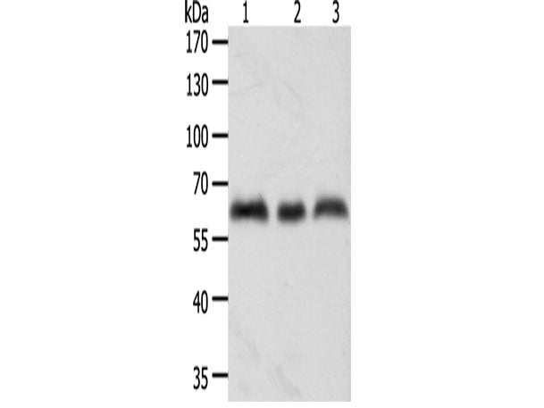 TYR Polyclonal Antibody Store at -20°C