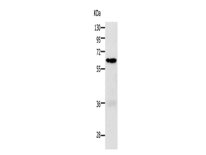 PAK1 Polyclonal Antibody Store at -20°C