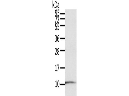 S100P Polyclonal Antibody Store at -20°C