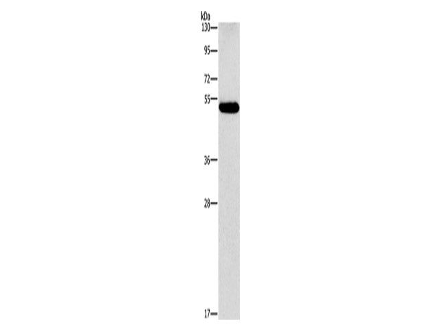 CALCRL Polyclonal Antibody Store at -20°C