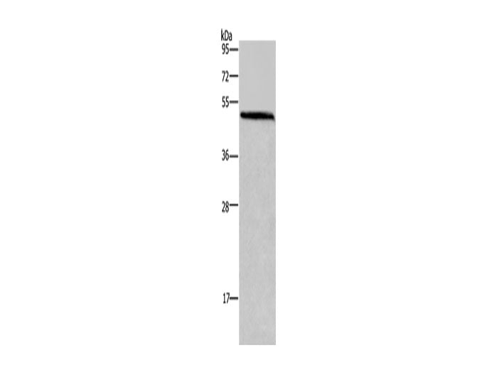 HOMER1 Polyclonal Antibody Store at -20°C