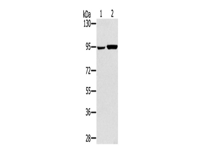PYGL Polyclonal Antibody Store at -20°C