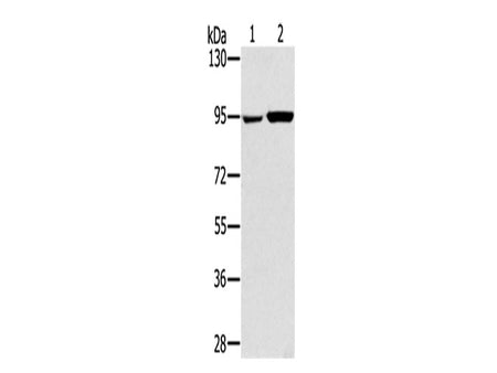 PYGL Polyclonal Antibody Store at -20°C