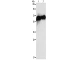 Placental Alkaline Phosphatase Polyclonal Antibody Store at -20°C