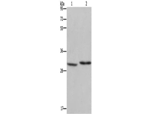 DHRS3 Polyclonal Antibody Store at -20°C