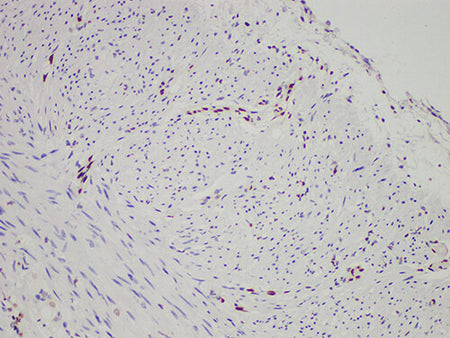 FLI1 Monoclonal Antibody Stored at -20°C