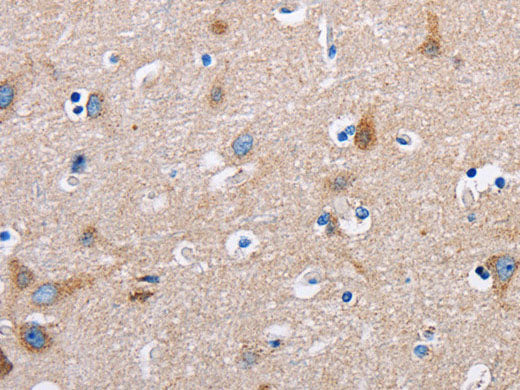 FN1 Polyclonal Antibody Store at -20°C