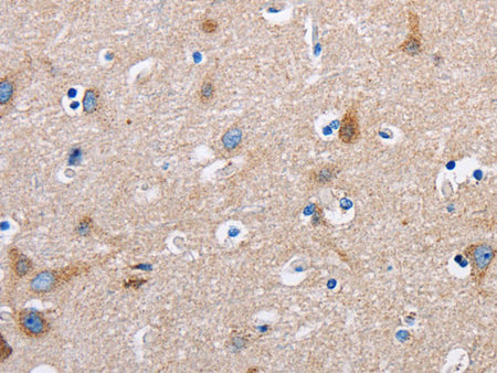 FN1 Polyclonal Antibody Store at -20°C