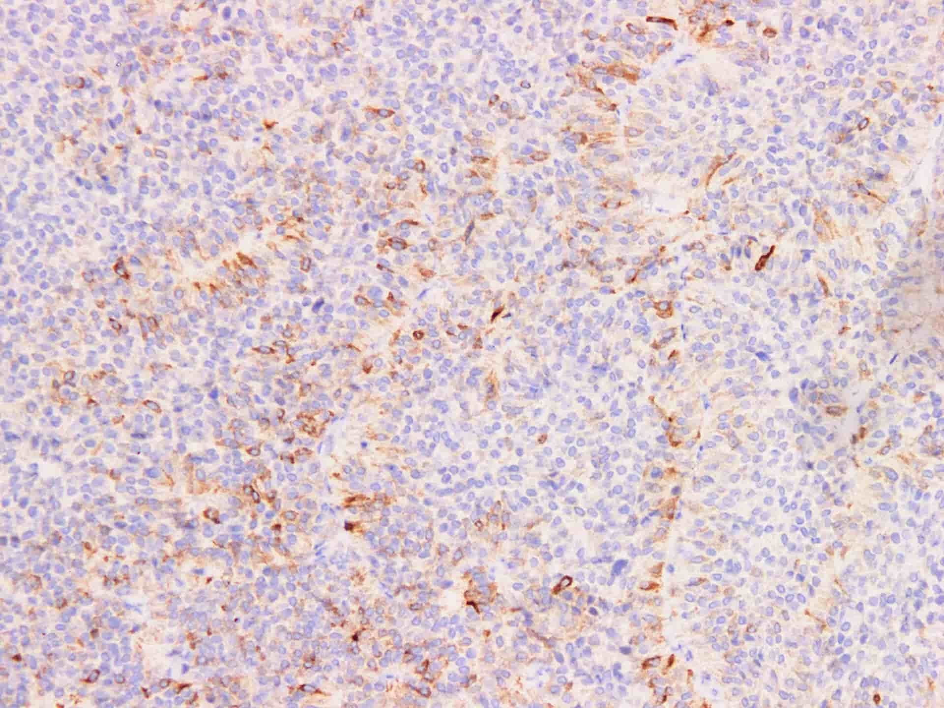 FSH Monoclonal Antibody Stored at -20°C