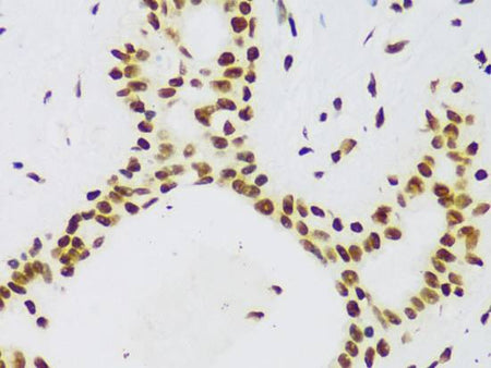 FUS Polyclonal Antibody
