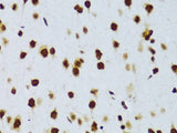 FUS Polyclonal Antibody