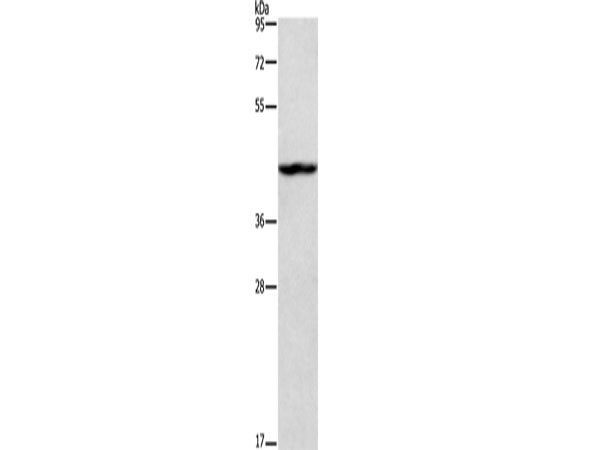 TBX20 Polyclonal Antibody Store at -20°C