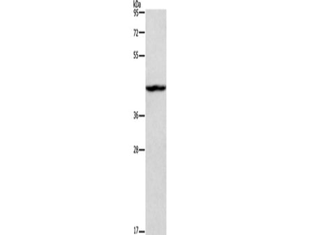 TBX20 Polyclonal Antibody Store at -20°C
