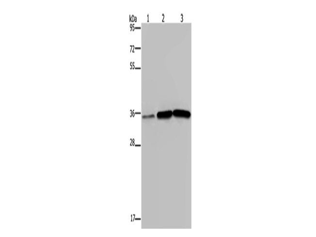 MAGEA3 Polyclonal Antibody